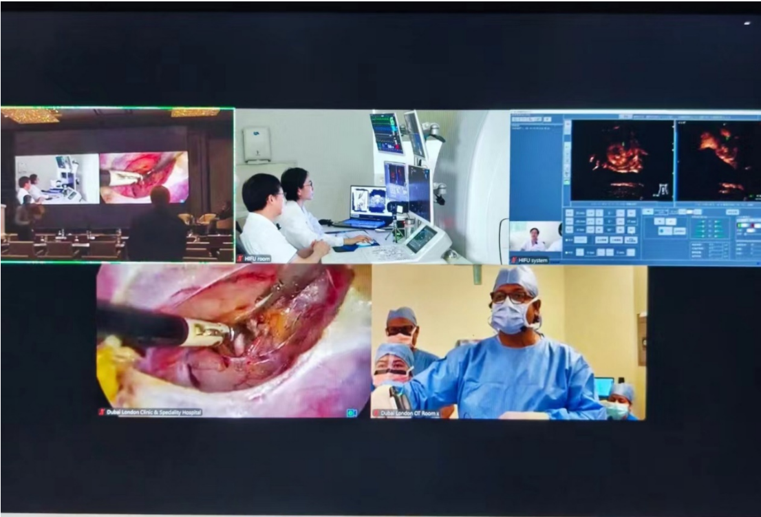 中国原创HIFU技术无创治疗子宫腺肌病在2024年国际微创手术会议引发强烈关注